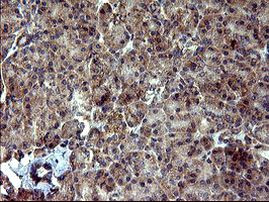 DNM1L Antibody in Immunohistochemistry (Paraffin) (IHC (P))