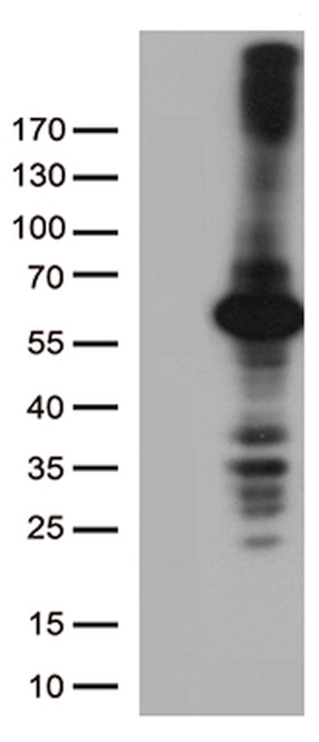DNPEP Antibody in Western Blot (WB)