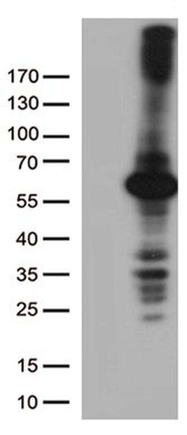 DNPEP Antibody in Western Blot (WB)