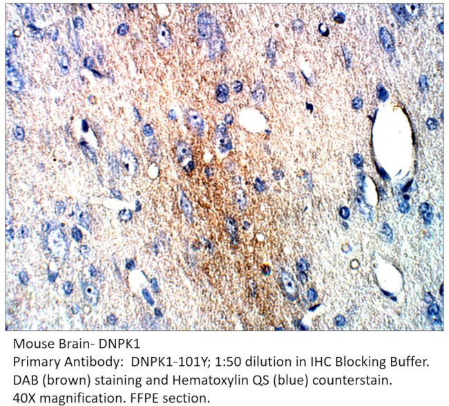 DNA PKcs Antibody in Immunohistochemistry (IHC)