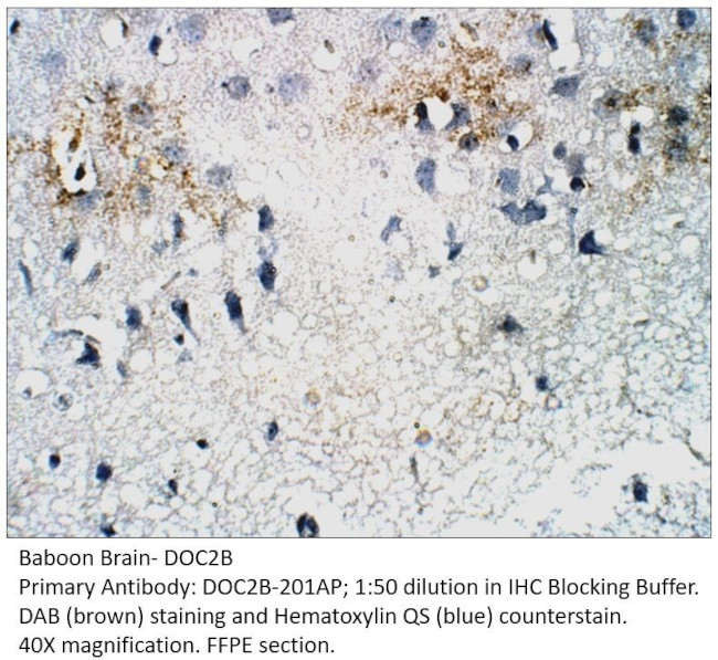 DOC2B Antibody in Immunohistochemistry (IHC)