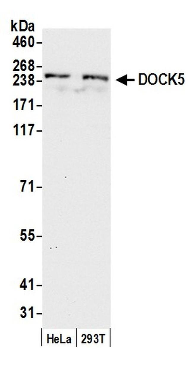 Dock5 DOCK5 Polyclonal Antibody (A304-988A-T)