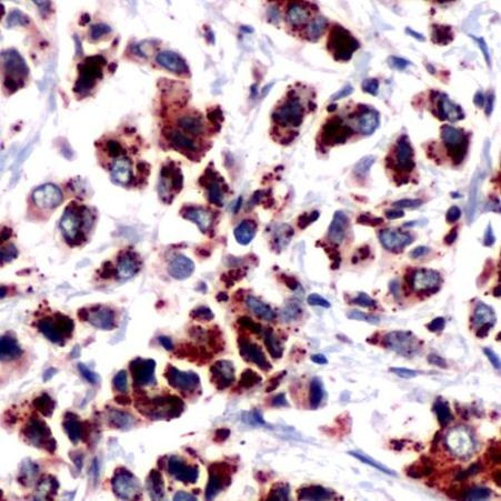 DOK2 Antibody in Immunohistochemistry (IHC)