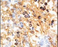 DOK1 Antibody in Immunohistochemistry (IHC)