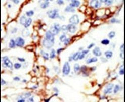 DOK2 Antibody in Immunohistochemistry (IHC)