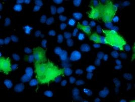 DOK2 Antibody in Immunocytochemistry (ICC/IF)