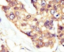 DOK5 Antibody in Immunohistochemistry (IHC)