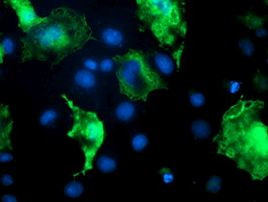 DOK7 Antibody in Immunocytochemistry (ICC/IF)