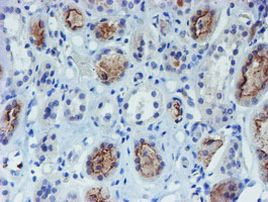 DOK7 Antibody in Immunohistochemistry (Paraffin) (IHC (P))