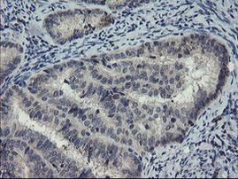 DOK7 Antibody in Immunohistochemistry (Paraffin) (IHC (P))