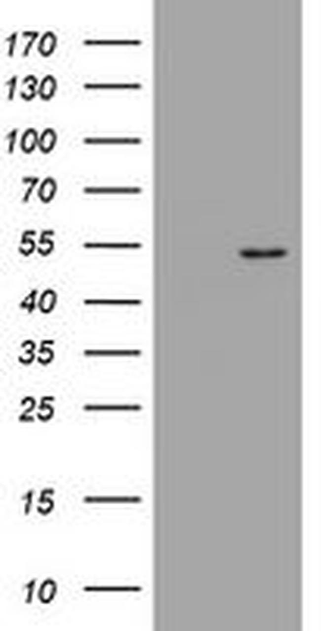 DOK7 Antibody in Western Blot (WB)