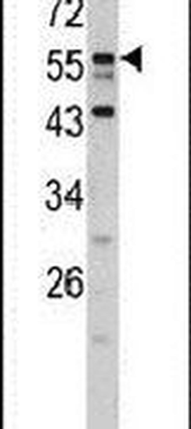 DONSON Antibody in Western Blot (WB)