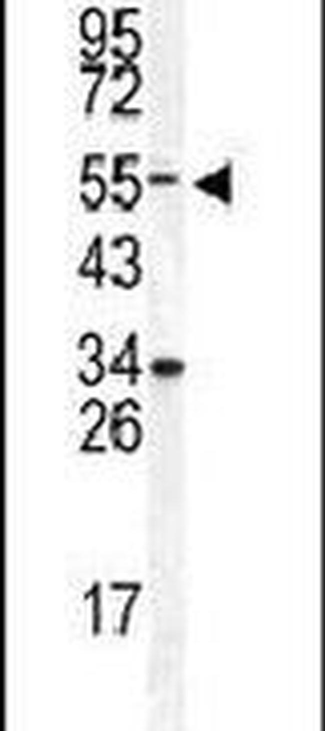 DONSON Antibody in Western Blot (WB)