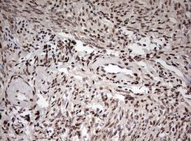 DOT1L Antibody in Immunohistochemistry (Paraffin) (IHC (P))