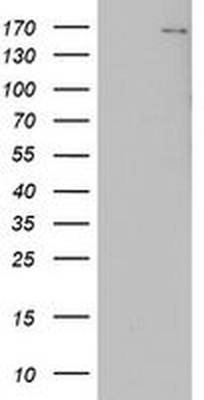 DOT1L Antibody in Western Blot (WB)