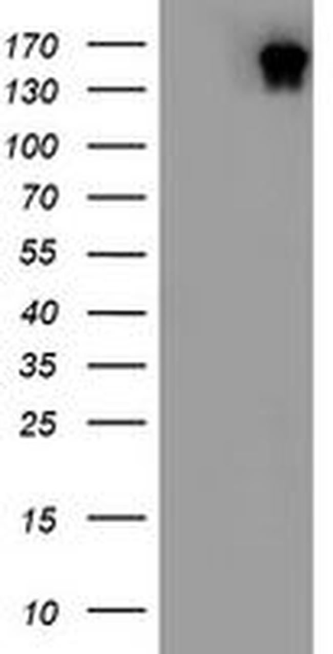 DOT1L Antibody in Western Blot (WB)