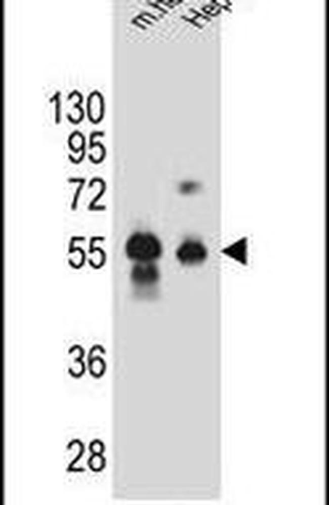 DPEP3 Antibody in Western Blot (WB)