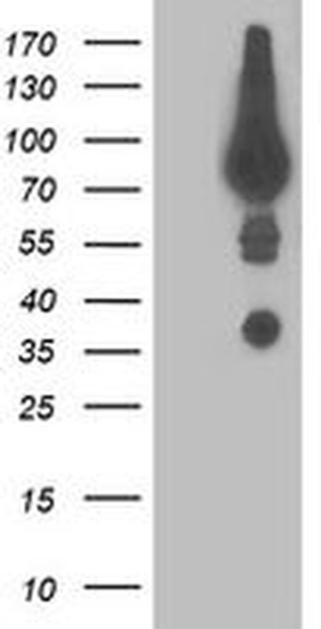 DPP3 Antibody in Western Blot (WB)
