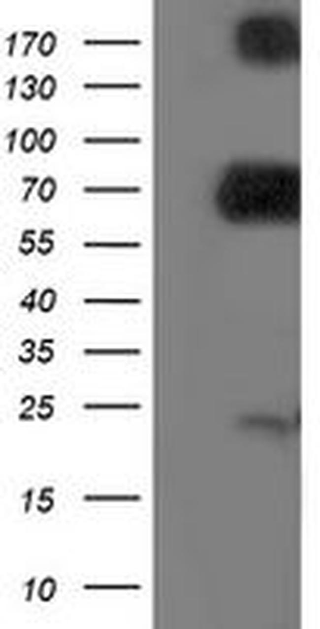 DPP3 Antibody in Western Blot (WB)