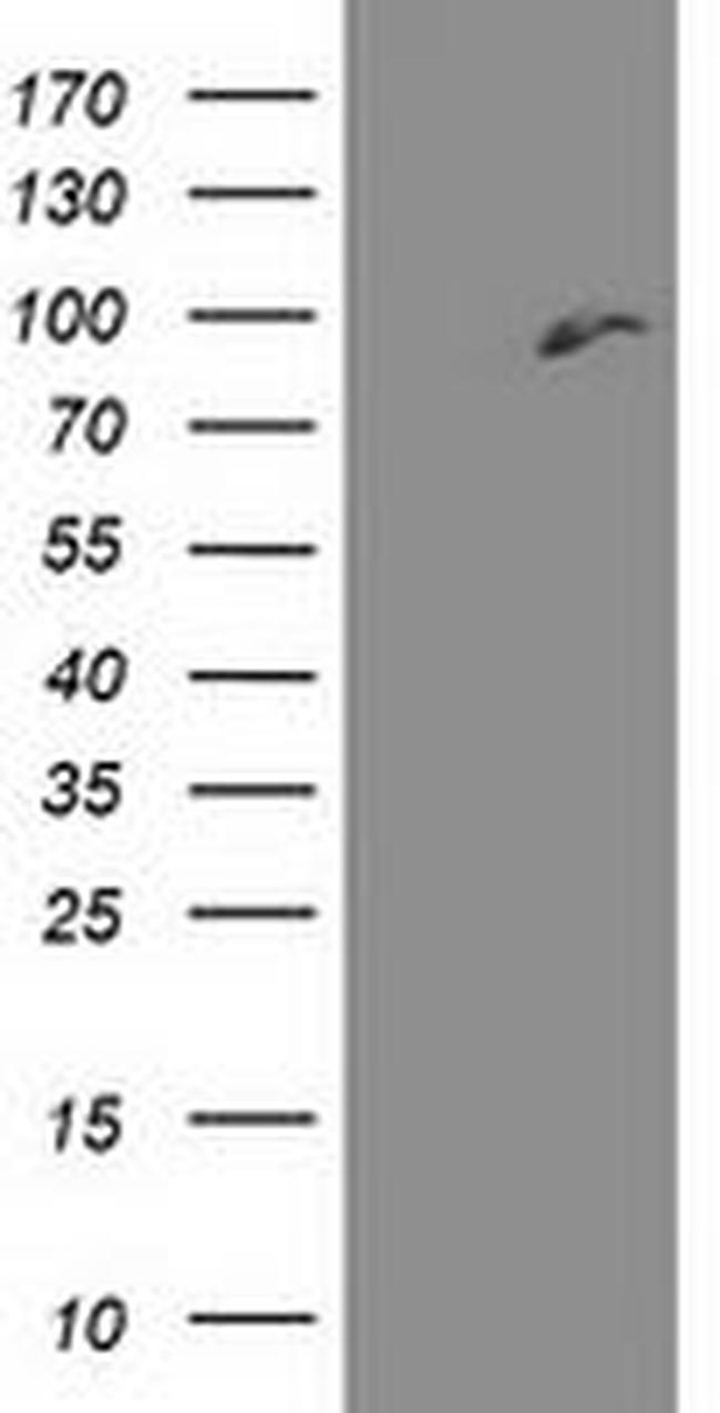 DPP3 Antibody in Western Blot (WB)