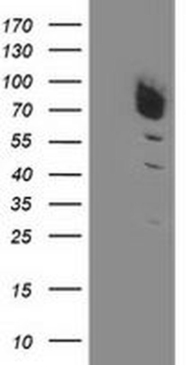 DPP3 Antibody in Western Blot (WB)
