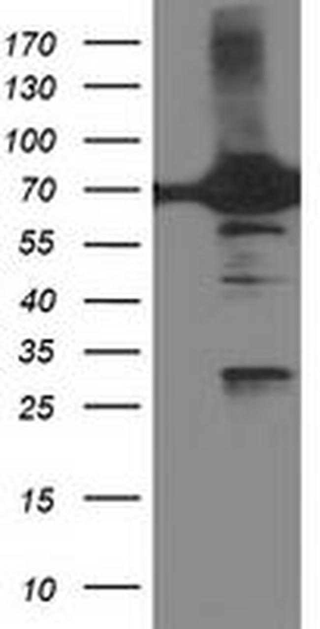 DPP3 Antibody in Western Blot (WB)