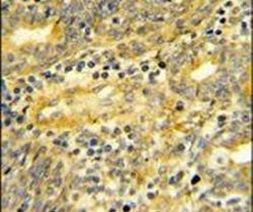 DPP8 Antibody in Immunohistochemistry (IHC)