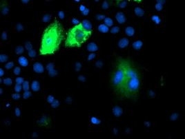 DPP9 Antibody in Immunocytochemistry (ICC/IF)