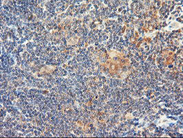 DPP9 Antibody in Immunohistochemistry (Paraffin) (IHC (P))