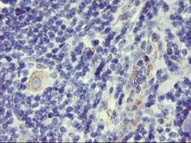 DPP9 Antibody in Immunohistochemistry (Paraffin) (IHC (P))