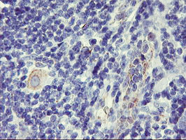 DPP9 Antibody in Immunohistochemistry (Paraffin) (IHC (P))