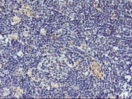 DPP9 Antibody in Immunohistochemistry (Paraffin) (IHC (P))