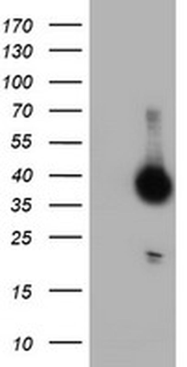 DPPA4 Antibody in Western Blot (WB)