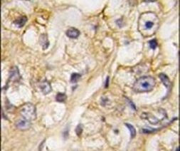 RGMB Antibody in Immunohistochemistry (IHC)