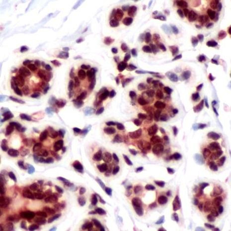 DRAK2 Antibody in Immunohistochemistry (IHC)
