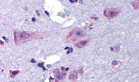 DRD3 Antibody in Immunohistochemistry (Paraffin) (IHC (P))