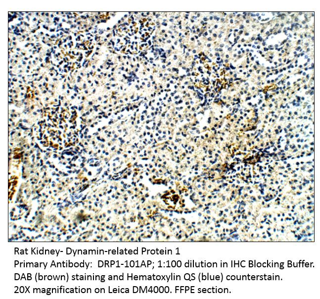 DRP1 Antibody in Immunohistochemistry (IHC)
