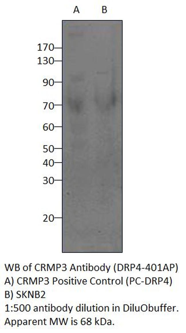 CRMP3 Antibody in Western Blot (WB)