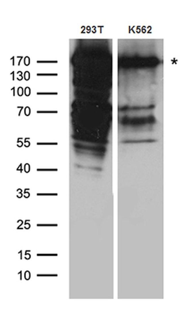 DSG1 Antibody in Western Blot (WB)