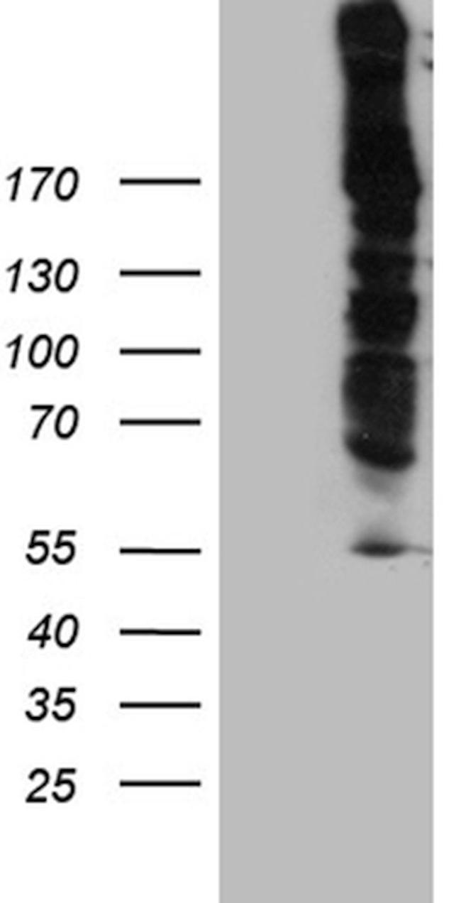 DSP Antibody in Western Blot (WB)