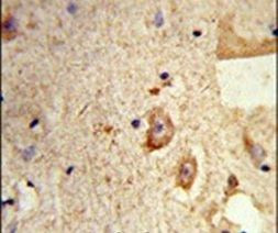 Destrin Antibody in Immunohistochemistry (IHC)