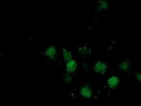 DSTN Antibody in Immunocytochemistry (ICC/IF)