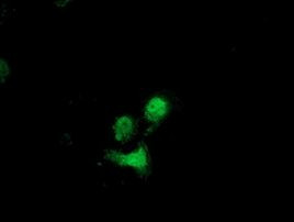 DSTN Antibody in Immunocytochemistry (ICC/IF)