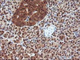 DSTN Antibody in Immunohistochemistry (Paraffin) (IHC (P))