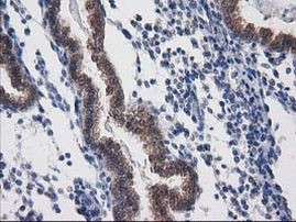 DSTN Antibody in Immunohistochemistry (Paraffin) (IHC (P))