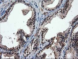 DSTN Antibody in Immunohistochemistry (Paraffin) (IHC (P))