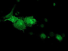 DTNA Antibody in Immunocytochemistry (ICC/IF)