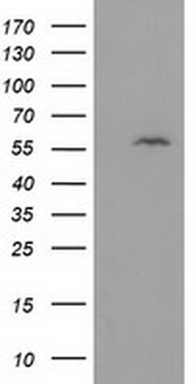 DTNA Antibody in Western Blot (WB)