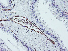 DTNB Antibody in Immunohistochemistry (Paraffin) (IHC (P))