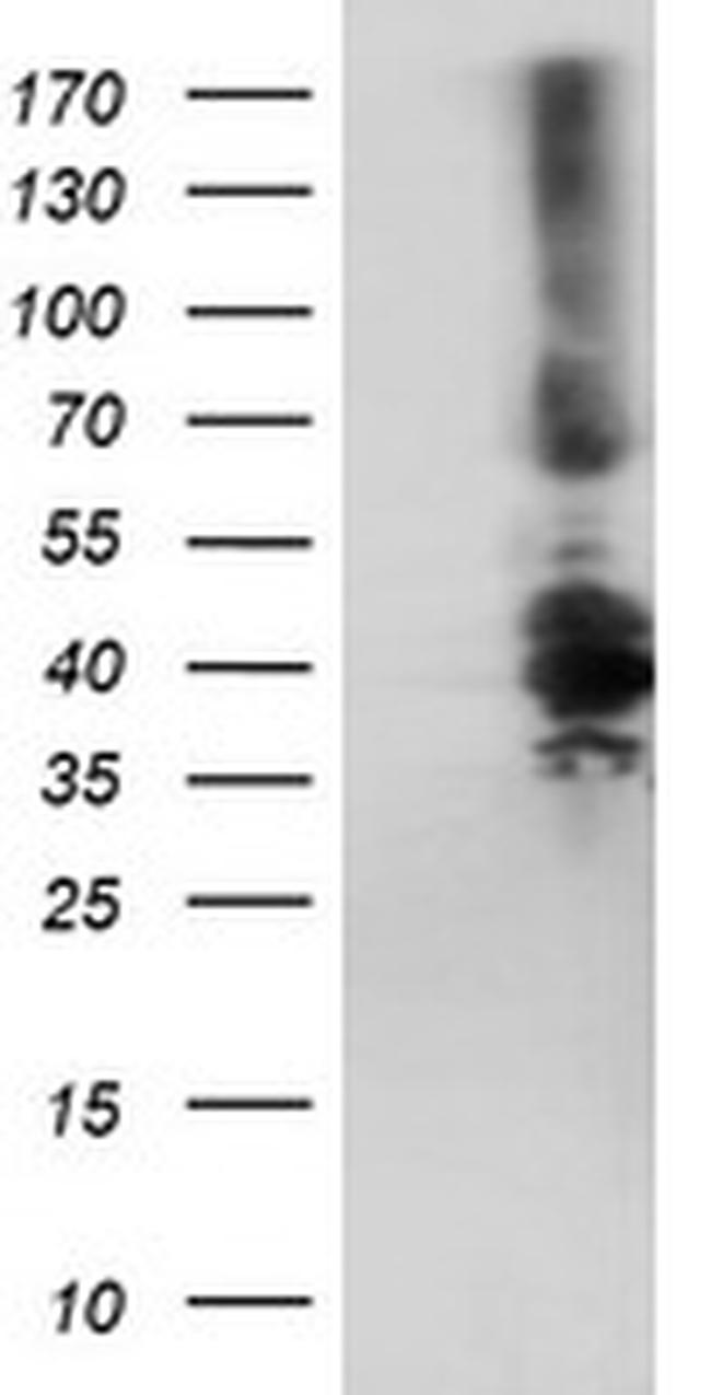 DTNB Antibody in Western Blot (WB)